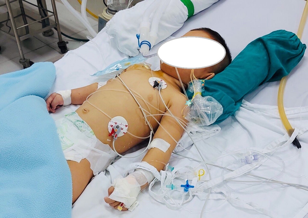 Ngã vào chậu nước, bé trai ở TP.HCM bị tổn thương não