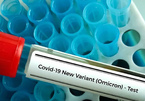Tỷ lệ nhiễm Omicron ở người từng mắc Covid-19 cao bất ngờ
