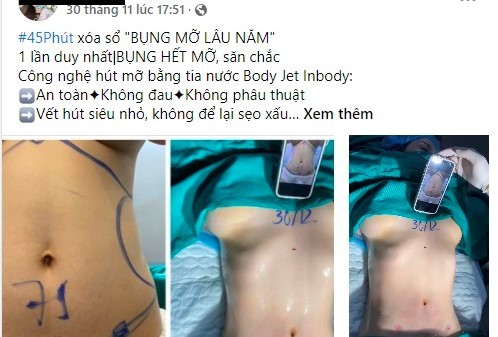 Vụ người phụ nữ 31 tuổi tử vong sau hút mỡ bụng: Nạn nhân là nhân viên spa