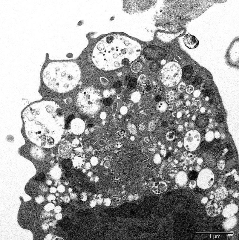 Công bố ảnh chụp đầu tiên của biến thể Omicron dưới kính hiển vi