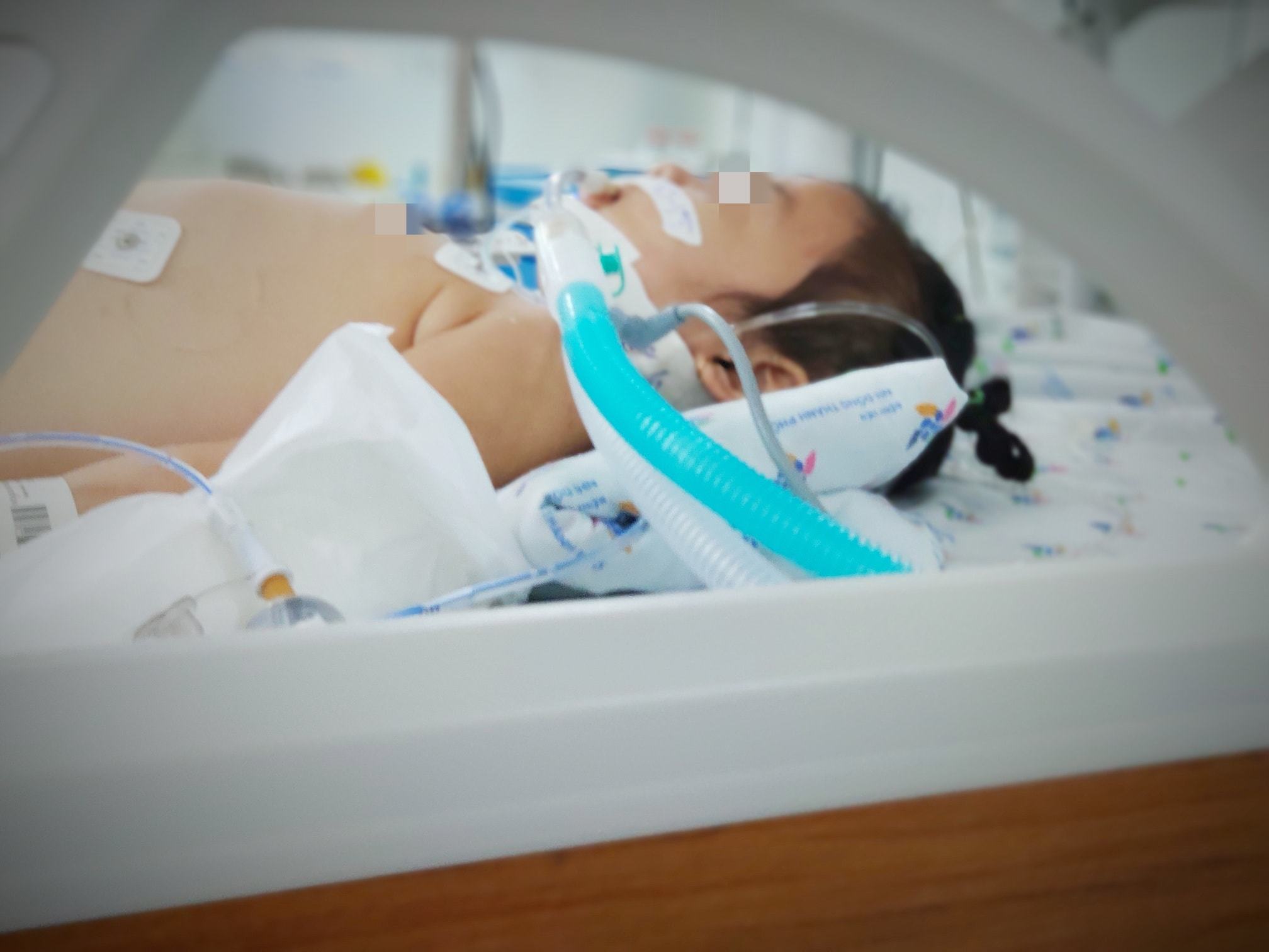 Bé gái 4 tuổi cấp cứu vì hội chứng 