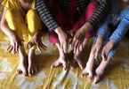 Gia đình 13 người có ngón tay chân kỳ lạ ở miền Tây