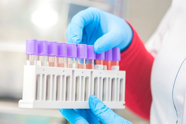 Thời gian ủ bệnh ngắn của Omicron có ý nghĩa thế nào?