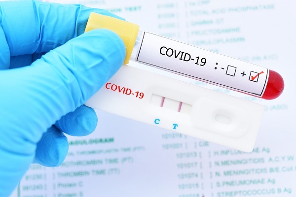 Bác sĩ chỉ cách tiết kiệm test nhanh khi tự xét nghiệm Covid-19 tại nhà