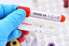 Biến chứng Covid-19 kéo dài hơn 1 năm của nữ y tá 31 tuổi