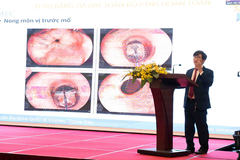 Tiến bộ vượt bậc trong phẫu thuật nội soi ung thư thực quản tại Việt Nam