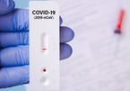 Dấu hiệu cảnh báo người nhiễm Covid-19 phải đi cấp cứu ngay