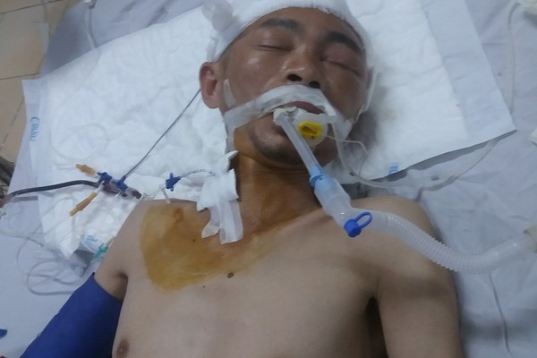 Cha tai biến nguy kịch, con tàn tật không nơi bấu víu