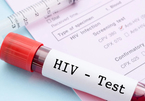 Nữ bệnh nhân đầu tiên chữa khỏi HIV