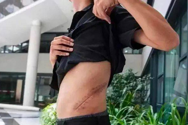 'Giá đắt' sau 10 năm của anh chàng bán thận trên 'chợ đen' mua iPhone