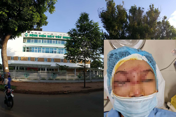 Mẹ bơm xe bị nổ lốp, mảnh vỡ bắn thẳng làm hỏng mắt con trai