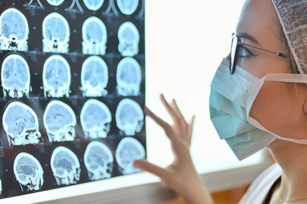 Bệnh nhân Covid-19 ít triệu chứng cũng có thể bị tổn thương não