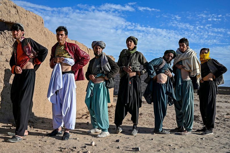Lý do đằng sau 'ngôi làng một quả thận' ở Afghanistan