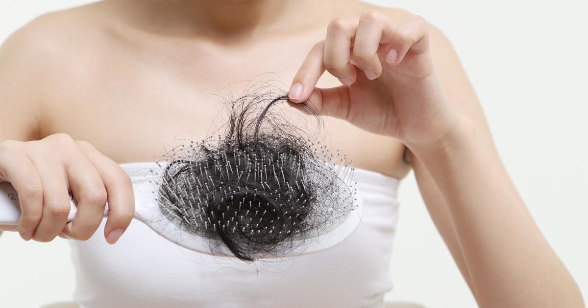 F0 from hair loss to baldness, the doctor shows how to fix it