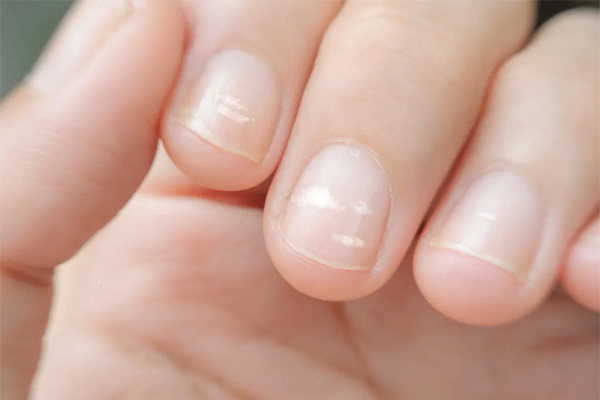 Small signs on nails warn of many potential dangers