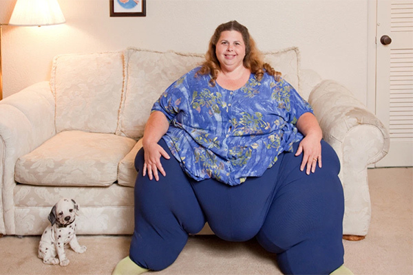 The world’s fattest woman has an unexpected appearance after 10 years of weight loss